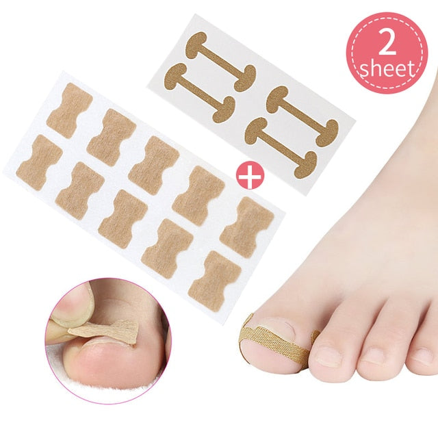 Ingrown Toenail Corrector Stickers