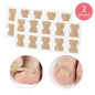 Ingrown Toenail Corrector Stickers