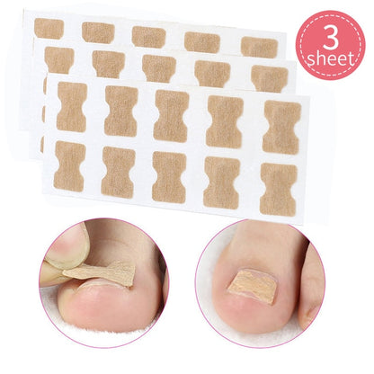 Ingrown Toenail Corrector Stickers