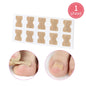 Ingrown Toenail Corrector Stickers