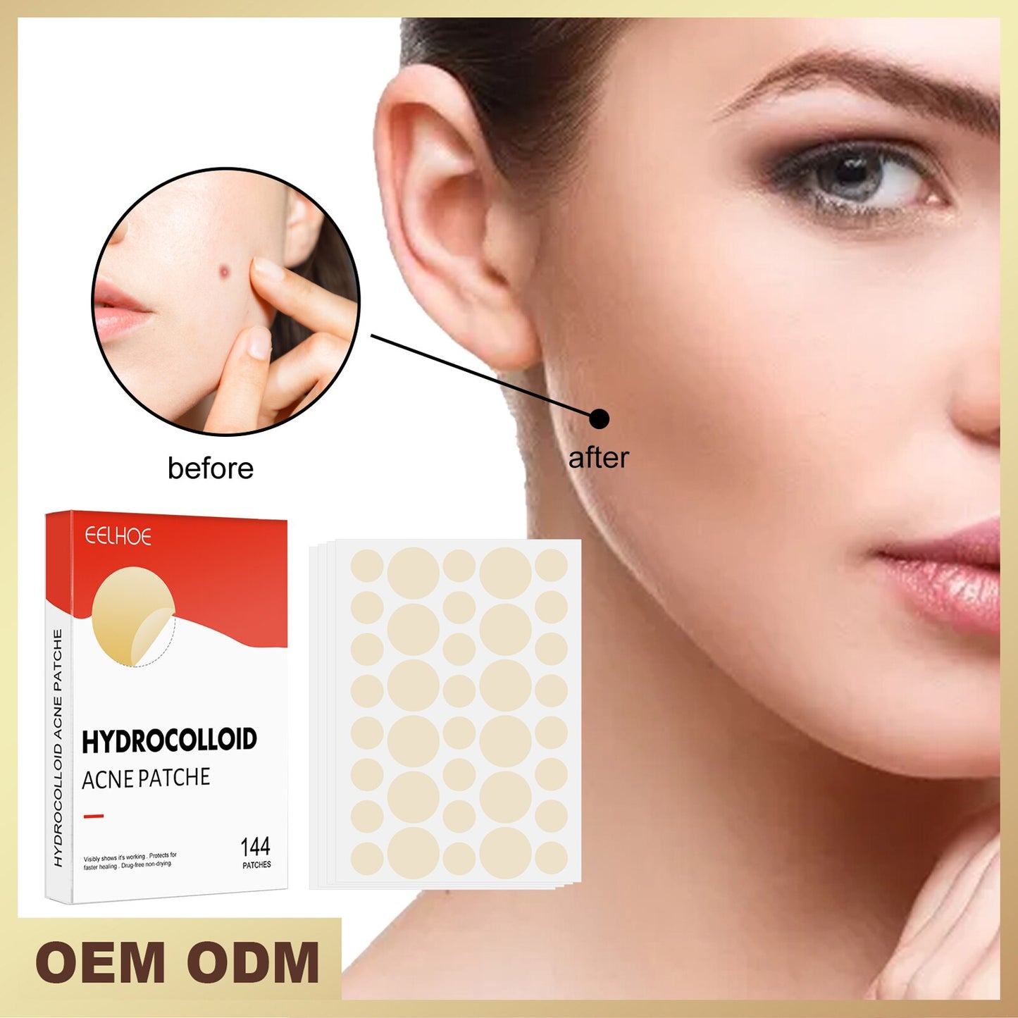 Hydrocolloid Acne Patch