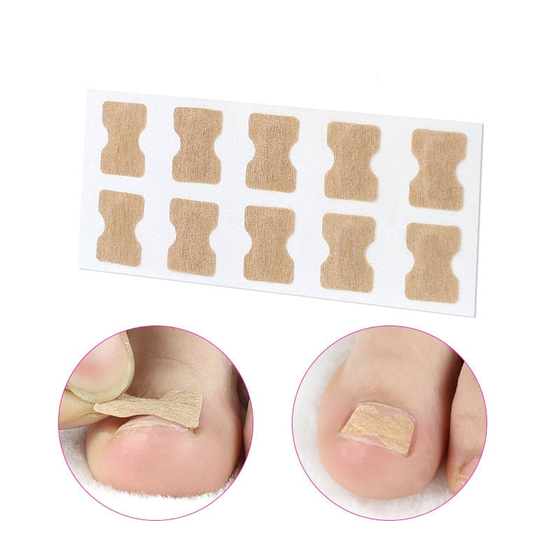 Ingrown Toenail Corrector Stickers